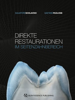 cover image of Direkte Restaurationen im Seitenzahnbereich